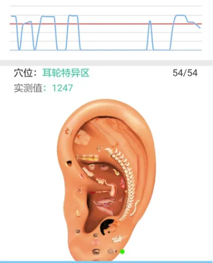 妙郎中耳穴检测2026官方正版 妙郎中耳穴检测2026官方正版
